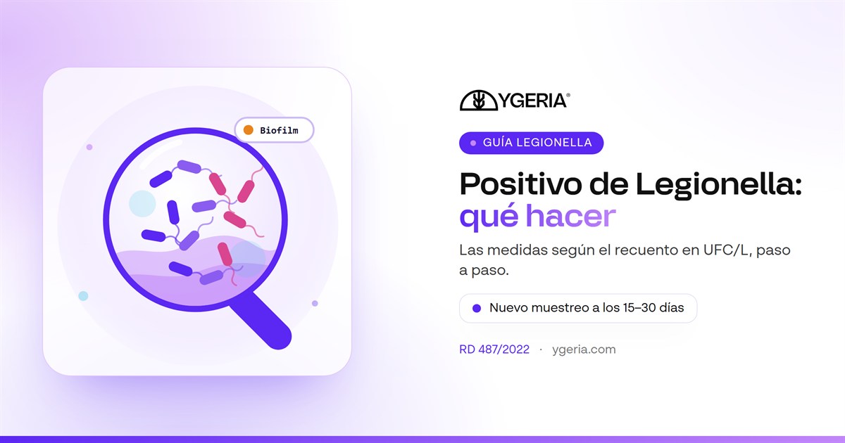 Positivo de Legionella: qué hacer, paso a paso, según el RD 487/2022